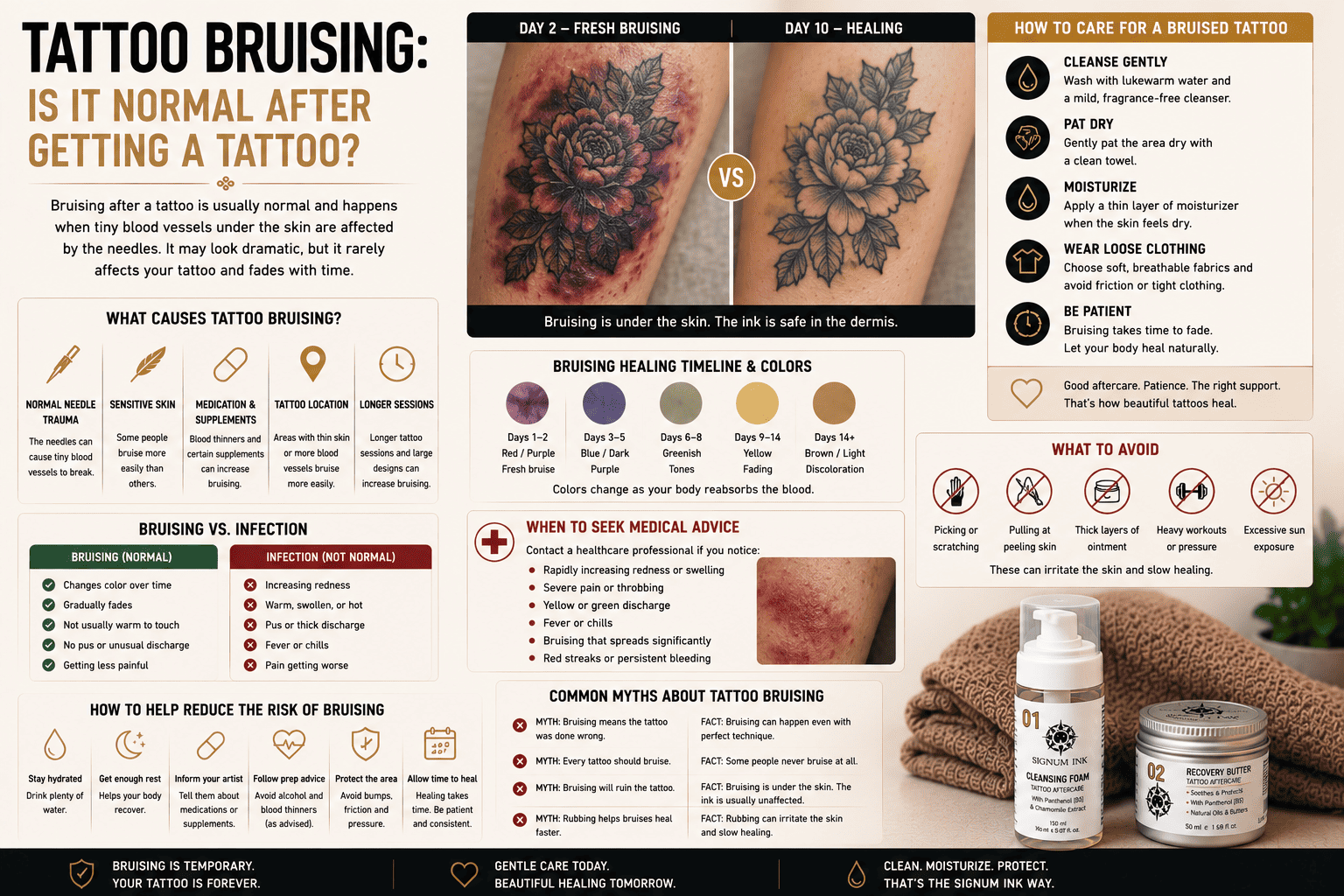 Tattoo Bruising